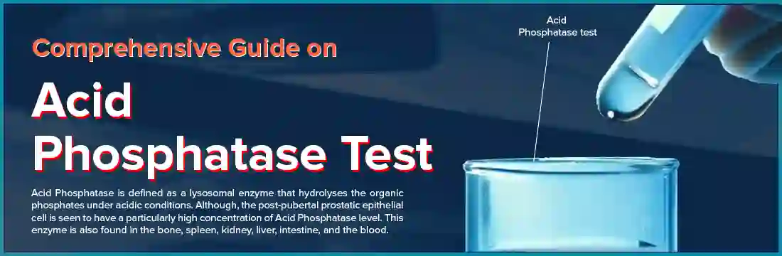 Comprehensive Guide on Acid Phosphatase Test